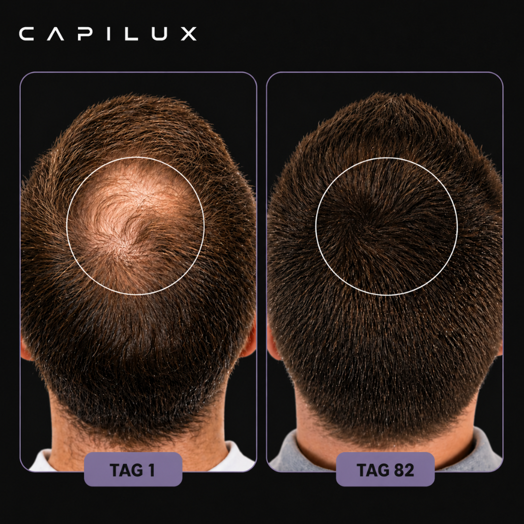 Rotlichttherapie-Mütze