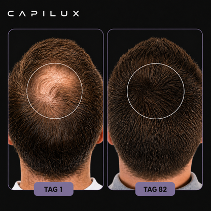 Rotlichttherapie-Mütze