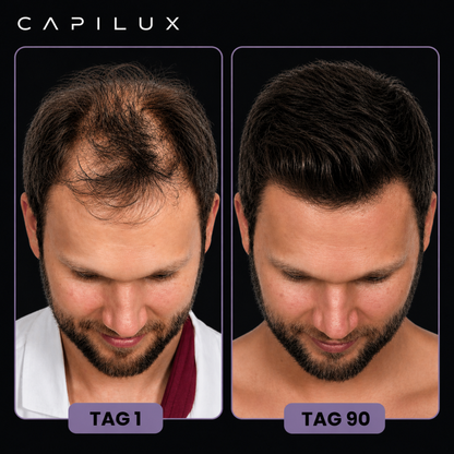 Rotlichttherapie-Mütze